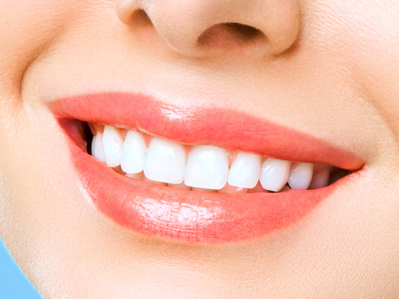 Dịch vụ bọc răng sứ cao cấp